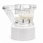 Maqueta Dental Transparente de Tratamientos con Implantes, Coronas e Incrustaciones