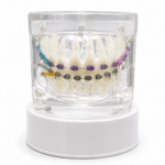 Maqueta Dental Transparente de Ortodoncia con Brackets y Microtornillos