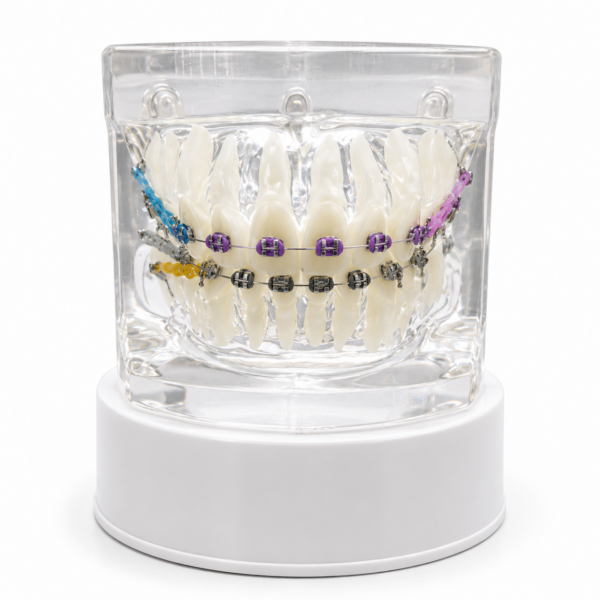 Maqueta Dental Transparente de Ortodoncia con Brackets y Microtornillos